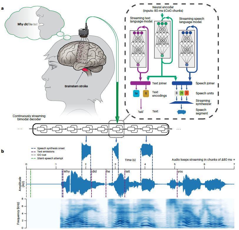 AI lets people with paralysis speak again using brain signals